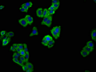 SLAMF6 / NTBA Antibody - Immunofluorescence staining of HepG2 cells at a dilution of 1:66, counter-stained with DAPI. The cells were fixed in 4% formaldehyde, permeabilized using 0.2% Triton X-100 and blocked in 10% normal Goat Serum. The cells were then incubated with the antibody overnight at 4 °C.The secondary antibody was Alexa Fluor 488-congugated AffiniPure Goat Anti-Rabbit IgG (H+L) .