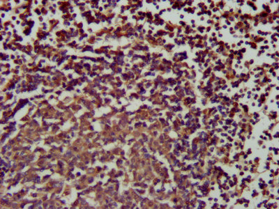 SLAMF6 / NTBA Antibody - Immunohistochemistry image at a dilution of 1:200 and staining in paraffin-embedded human lymph node tissue performed on a Leica BondTM system. After dewaxing and hydration, antigen retrieval was mediated by high pressure in a citrate buffer (pH 6.0) . Section was blocked with 10% normal goat serum 30min at RT. Then primary antibody (1% BSA) was incubated at 4 °C overnight. The primary is detected by a biotinylated secondary antibody and visualized using an HRP conjugated SP system.