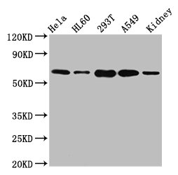 SLAMF6 / NTBA Antibody - Positive Western Blot detected in Hela whole cell lysate, HL60 whole cell lysate, 293T whole cell lysate, A549 whole cell lysate, Mouse kidney tissue. All lanes: SLAMF6 antibody at 5.1 µg/ml Secondary Goat polyclonal to rabbit IgG at 1/50000 dilution. Predicted band size: 38, 25 KDa. Observed band size: 60 KDa