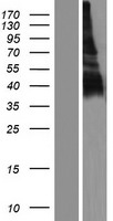 SLAMF6 / NTBA Protein - Western validation with an anti-DDK antibody * L: Control HEK293 lysate R: Over-expression lysate