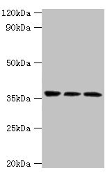 SLAMF7 / CRACC Antibody - Western blot All lanes: SLAMF7 antibody at 3µg/ml Lane 1: Jurkat whole cell lysate Lane 2: K562 whole cell lysate Lane 3: Mouse spleen tissue Secondary Goat polyclonal to rabbit IgG at 1/10000 dilution Predicted band size: 38, 26, 18, 33, 23, 22 kDa Observed band size: 38 kDa