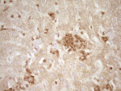 SLAMF7 / CRACC Antibody - Immunohistochemical staining of paraffin-embedded Human liver tissue within the normal limits using anti-SLAMF7 mouse monoclonal antibody. (Heat-induced epitope retrieval by 1 mM EDTA in 10mM Tris, pH8.5, 120C for 3min,