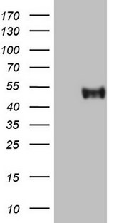 SLAMF7 / CRACC Antibody - HEK293T cells were transfected with the pCMV6-ENTRY control (Left lane) or pCMV6-ENTRY SLAMF7 (Right lane) cDNA for 48 hrs and lysed. Equivalent amounts of cell lysates (5 ug per lane) were separated by SDS-PAGE and immunoblotted with anti-SLAMF7.