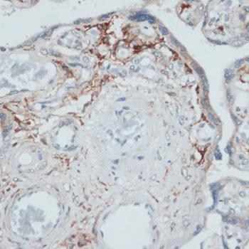 SLAMF7 / CRACC Antibody - Immunohistochemistry of paraffin-embedded Human placenta using SLAMF7 Polyclonal Antibody at dilution of 1:100 (40x lens).