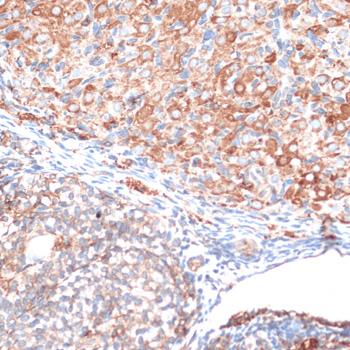 SLAMF7 / CRACC Antibody - Immunohistochemistry of paraffin-embedded Rat ovary using SLAMF7 Polyclonal Antibody at dilution of 1:100 (40x lens).