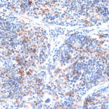 SLAMF7 / CRACC Antibody - Immunohistochemistry of paraffin-embedded Rat spleen using SLAMF7 Polyclonal Antibody at dilution of 1:100 (40x lens).
