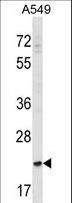 SLAMF9 Antibody - SLAMF9 Antibody western blot of A549 cell line lysates (35 ug/lane). The SLAMF9 antibody detected the SLAMF9 protein (arrow).