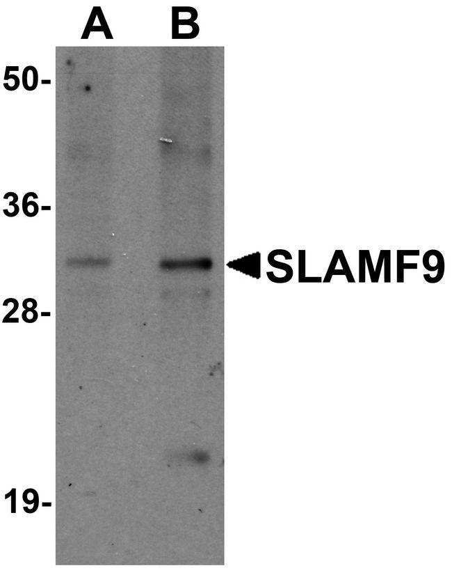 SLAMF9 Antibody - Western blot analysis of SLAMF9 in mouse kidney tissue lysate with SLAMF9 antibody at (A) 1 and (B) 2 ug/ml.