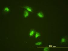 SLBP Antibody - Immunofluorescence of monoclonal antibody to SLBP on HeLa cell. [antibody concentration 10 ug/ml]