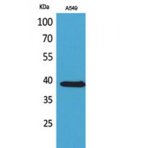 SLC10A1 / NTCP Antibody - Western blot of NTCP antibody