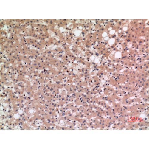 SLC10A1 / NTCP Antibody - Immunohistochemistry of NTCP antibody