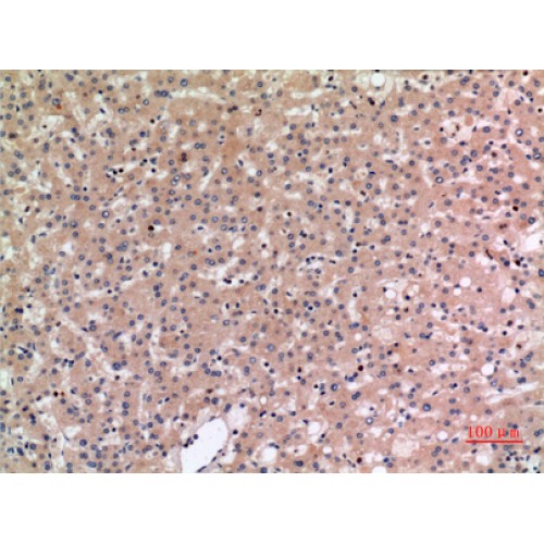 SLC10A1 / NTCP Antibody - Immunohistochemistry of NTCP antibody