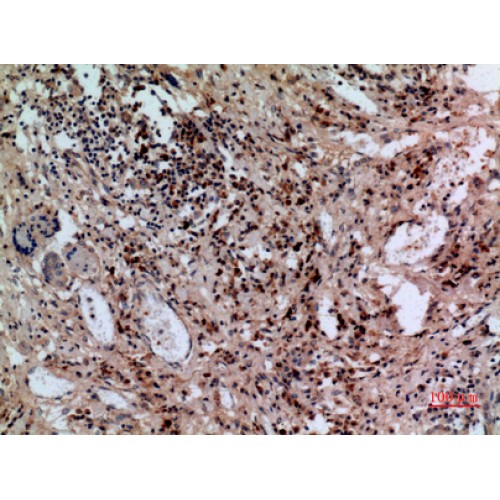 SLC10A1 / NTCP Antibody - Immunohistochemistry of NTCP antibody