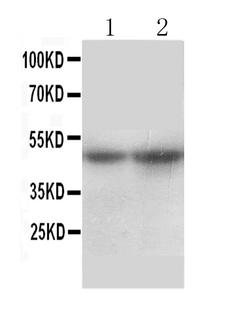SLC10A1 / NTCP Antibody - Anti-SLC10A1 antibody, Western blotting All lanes: Anti SLC10A1 at 0.5ug/ml Lane 1: Rat Liver Tissue Lysate at 50ug Lane 2: Mouse Liver Tissue Lysate at 50ug Predicted bind size: 38-56KD Observed bind size: 49KD