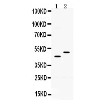 SLC10A1 / NTCP Antibody - SLC10A1 antibody Western blot. All lanes: Anti SLC10A1 at 0.5 ug/ml. Lane 1: Rat Liver Tissue Lysate at 50 ug. Lane 2: Mouse Liver Tissue Lysate at 50 ug. Predicted band size: 45, 50 kD. Observed band size: 45, 50 kD.