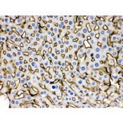 SLC10A1 / NTCP Antibody - SLC10A1 antibody IHC-paraffin. IHC(P): Mouse Liver Tissue.