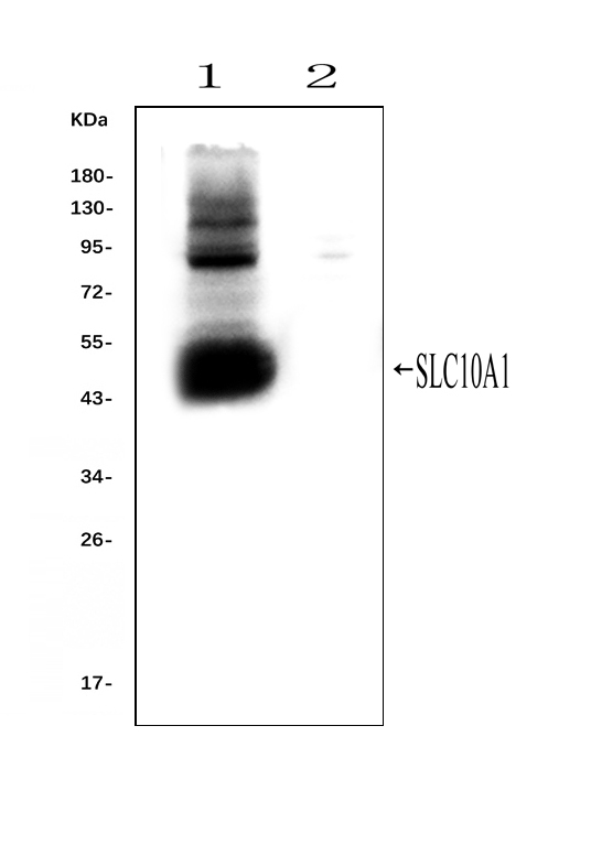 SLC10A1 / NTCP Antibody - Western blot analysis of SLC10A1 using anti-SLC10A1 antibody. Electrophoresis was performed on a 5-20% SDS-PAGE gel at 70V (Stacking gel) / 90V (Resolving gel) for 2-3 hours. The sample well of each lane was loaded with 50ug of sample under reducing conditions. Lane 1: rat liver tissue lysates (positive control), Lane 2: rat kidney tissue lysates, (negative control) After Electrophoresis, proteins were transferred to a Nitrocellulose membrane at 150mA for 50-90 minutes. Blocked the membrane with 5% Non-fat Milk/ TBS for 1.5 hour at RT. The membrane was incubated with rabbit anti-SLC10A1 antigen affinity purified polyclonal antibody at 0.25 µg/mL overnight at 4°C, then washed with TBS-0.1% Tween 3 times with 5 minutes each and probed with a goat anti-rabbit IgG-HRP secondary antibody at a dilution of 1:10000 for 1.5 hour at RT. The signal is developed using an Enhanced Chemiluminescent detection (ECL) kit with Tanon 5200 system. A specific band was detected for SLC10A1 at approximately 50KD. The expected band size for SLC10A1 is at 38KD.