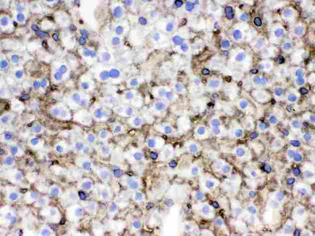 SLC10A1 / NTCP Antibody - IHC analysis of SLC10A1 using anti-SLC10A1 antibody. SLC10A1 was detected in frozen section of mouse liver tissue . Heat mediated antigen retrieval was performed in citrate buffer (pH6, epitope retrieval solution) for 20 mins. The tissue section was blocked with 10% goat serum. The tissue section was then incubated with 1µg/ml rabbit anti-SLC10A1 Antibody overnight at 4°C. Biotinylated goat anti-rabbit IgG was used as secondary antibody and incubated for 30 minutes at 37°C. The tissue section was developed using Strepavidin-Biotin-Complex (SABC) with DAB as the chromogen.