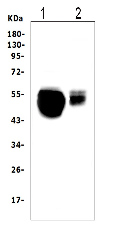 SLC10A1 / NTCP Antibody - Western blot analysis of SLC10A1 using anti-SLC10A1 antibody. Electrophoresis was performed on a 5-20% SDS-PAGE gel at 70V (Stacking gel) / 90V (Resolving gel) for 2-3 hours. The sample well of each lane was loaded with 50ug of sample under reducing conditions. Lane 1: rat liver tissue lysates, Lane 2: mouse liver tissue lysates, After Electrophoresis, proteins were transferred to a Nitrocellulose membrane at 150mA for 50-90 minutes. Blocked the membrane with 5% Non-fat Milk/ TBS for 1.5 hour at RT. The membrane was incubated with rabbit anti-SLC10A1 antigen affinity purified polyclonal antibody at 0.5 µg/mL overnight at 4°C, then washed with TBS-0.1% Tween 3 times with 5 minutes each and probed with a goat anti-rabbit IgG-HRP secondary antibody at a dilution of 1:10000 for 1.5 hour at RT. The signal is developed using an Enhanced Chemiluminescent detection (ECL) kit with Tanon 5200 system. A specific band was detected for SLC10A1 at approximately 50KD. The expected band size for SLC10A1 is at 38KD.