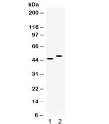 SLC10A1 / NTCP Antibody