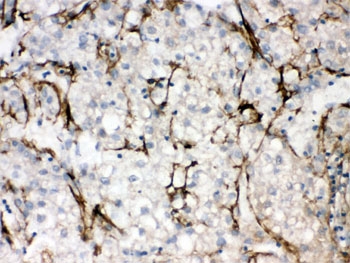 SLC10A1 / NTCP Antibody