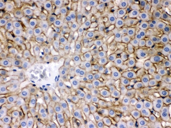 SLC10A1 / NTCP Antibody