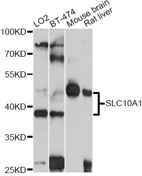SLC10A1 / NTCP Antibody - Western blot analysis of extracts of various cell lines, using SLC10A1 antibody at 1:1000 dilution. The secondary antibody used was an HRP Goat Anti-Rabbit IgG (H+L) at 1:10000 dilution. Lysates were loaded 25ug per lane and 3% nonfat dry milk in TBST was used for blocking. An ECL Kit was used for detection and the exposure time was 5s.