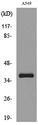 SLC10A1 / NTCP Antibody - Western blot analysis of lysate from A549 cells, using SLC10A1 Antibody.