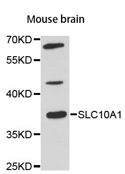 SLC10A1 / NTCP Antibody - Western blot analysis of extracts of mouse brain, using SLC10A1 antibody at 1:3000 dilution. The secondary antibody used was an HRP Goat Anti-Rabbit IgG (H+L) at 1:10000 dilution. Lysates were loaded 25ug per lane and 3% nonfat dry milk in TBST was used for blocking. An ECL Kit was used for detection and the exposure time was 90s.