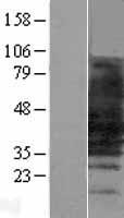 SLC10A1 / NTCP Protein - Western validation with an anti-DDK antibody * L: Control HEK293 lysate R: Over-expression lysate