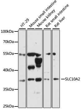 SLC10A2 / ASBT Antibody - Western blot analysis of extracts of various cell lines, using SLC10A2 antibody at 1:3000 dilution. The secondary antibody used was an HRP Goat Anti-Rabbit IgG (H+L) at 1:10000 dilution. Lysates were loaded 25ug per lane and 3% nonfat dry milk in TBST was used for blocking. An ECL Kit was used for detection and the exposure time was 30s.