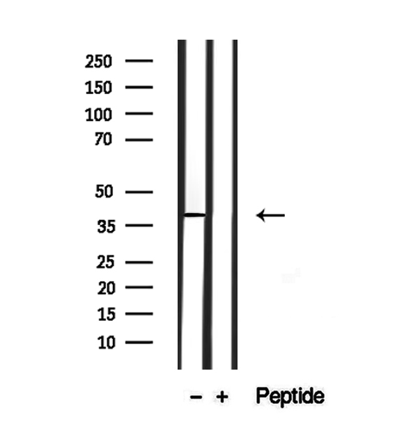 SLC10A2 / ASBT Antibody - Western blot analysis of extracts of mouse kidney using ASBT antibody.