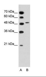 SLC10A5 Antibody - A: Marker, B: Jurkat Cell Lysate.  This image was taken for the unconjugated form of this product. Other forms have not been tested.