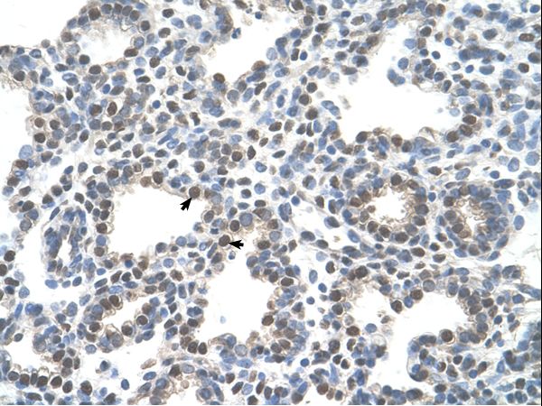 SLC10A5 Antibody - SLC10A5 antibody ARP43773_T100-NP_001010893-SLC10A5(solute carrier family 10 (sodium/bile acid cotransporter family), member 5) Antibody was used in IHC to stain formalin-fixed, paraffin-embedded human lung.  This image was taken for the unconjugated form of this product. Other forms have not been tested.