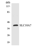 SLC10A7 Antibody - Western blot analysis of the lysates from 293 cells using SLC10A7 antibody.