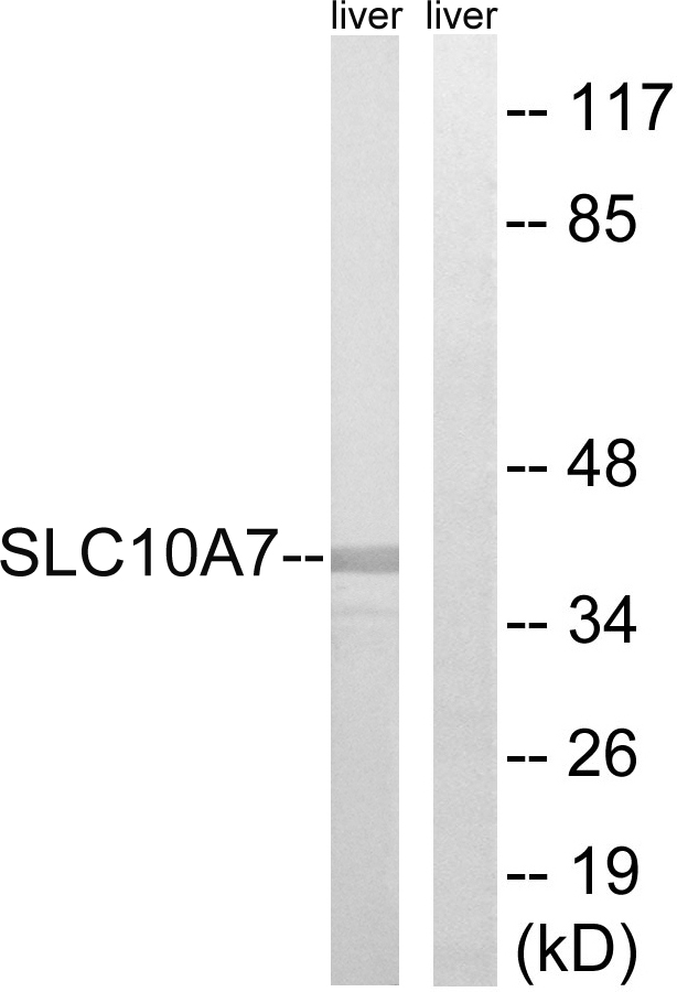 SLC10A7 Antibody - Western blot analysis of lysates from mouse liver, using SLC10A7 Antibody. The lane on the right is blocked with the synthesized peptide.