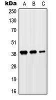 SLC10A7 Antibody - Western blot analysis of SLC10A7 expression in HeLa (A); HepG2 (B); H9C2 (C) whole cell lysates.