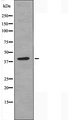 SLC10A7 Antibody - Western blot analysis of extracts of mouse liver cells using SLC10A7 antibody.