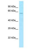 SLC11A1 / NRAMP Antibody - SLC11A1 / NRAMP antibody Western Blot of HT1080. Antibody dilution: 1 ug/ml.  This image was taken for the unconjugated form of this product. Other forms have not been tested.