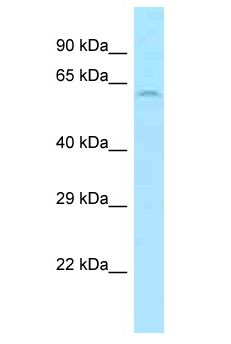 SLC11A1 / NRAMP Antibody - SLC11A1 / NRAMP antibody Western Blot of HT1080. Antibody dilution: 1 ug/ml.  This image was taken for the unconjugated form of this product. Other forms have not been tested.