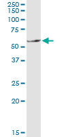 SLC11A1 / NRAMP Antibody - SLC11A1 monoclonal antibody (M01), clone 2G2. Western Blot analysis of SLC11A1 expression in human liver.