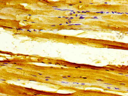 SLC11A1 / NRAMP Antibody - Immunohistochemistry image at a dilution of 1:300 and staining in paraffin-embedded human skeletal muscle tissue performed on a Leica BondTM system. After dewaxing and hydration, antigen retrieval was mediated by high pressure in a citrate buffer (pH 6.0) . Section was blocked with 10% normal goat serum 30min at RT. Then primary antibody (1% BSA) was incubated at 4 °C overnight. The primary is detected by a biotinylated secondary antibody and visualized using an HRP conjugated SP system.