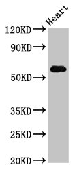 SLC11A1 / NRAMP Antibody - Positive Western Blot detected in Rat heart tissue. All lanes: SLC11A1 antibody at 5 µg/ml Secondary Goat polyclonal to rabbit IgG at 1/50000 dilution. Predicted band size: 60, 48 KDa. Observed band size: 60 KDa