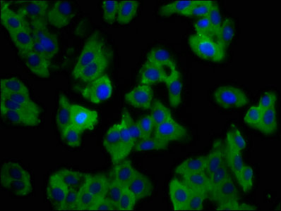 SLC11A1 / NRAMP Antibody - Immunofluorescence staining of HepG2 cells with SLC11A1 Antibody at 1:100, counter-stained with DAPI. The cells were fixed in 4% formaldehyde, permeabilized using 0.2% Triton X-100 and blocked in 10% normal Goat Serum. The cells were then incubated with the antibody overnight at 4°C. The secondary antibody was Alexa Fluor 488-congugated AffiniPure Goat Anti-Rabbit IgG(H+L).