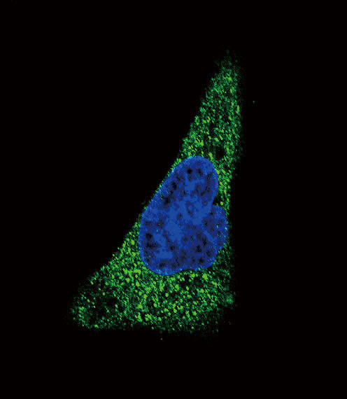SLC11A2 / DMT1 Antibody - Confocal immunofluorescence of SLC11A2 Antibody with HepG2 cell followed by Alexa Fluor 488-conjugated goat anti-rabbit lgG (green). DAPI was used to stain the cell nuclear (blue).
