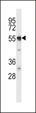 SLC11A2 / DMT1 Antibody - SLC11A2 Antibody western blot of mouse cerebellum tissue lysates (35 ug/lane). The SLC11A2 antibody detected the SLC11A2 protein (arrow).