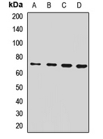 SLC11A2 / DMT1 Antibody