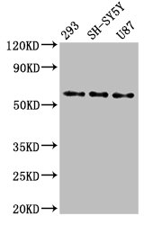 SLC11A2 / DMT1 Antibody - Positive Western Blot detected in 293 whole cell lysate, SH-SY5Y whole cell lysate, U87 whole cell lysate. All lanes: SLC11A2 antibody at 3 µg/ml Secondary Goat polyclonal to rabbit IgG at 1/50000 dilution. Predicted band size: 63, 62, 65, 66 KDa. Observed band size: 63 KDa