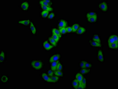 SLC11A2 / DMT1 Antibody - Immunofluorescence staining of HepG2 cells with SLC11A2 Antibody at 1:100, counter-stained with DAPI. The cells were fixed in 4% formaldehyde, permeabilized using 0.2% Triton X-100 and blocked in 10% normal Goat Serum. The cells were then incubated with the antibody overnight at 4°C. The secondary antibody was Alexa Fluor 488-congugated AffiniPure Goat Anti-Rabbit IgG(H+L).