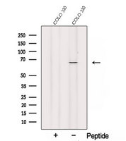 SLC11A2 / DMT1 Antibody - Western blot analysis of extracts of COLO 320 cells using SLC11A2 antibody. The lane on the left was treated with blocking peptide.